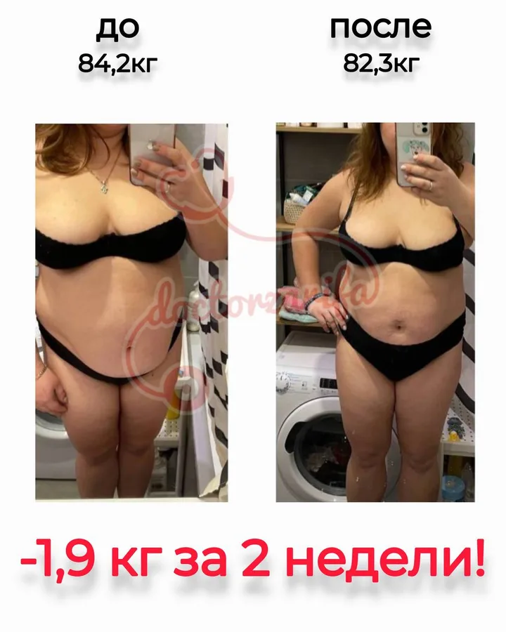 Результат пациента — до и после
