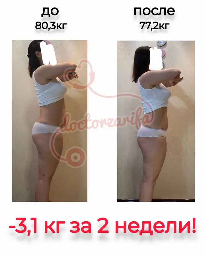Результат пациента — до и после
