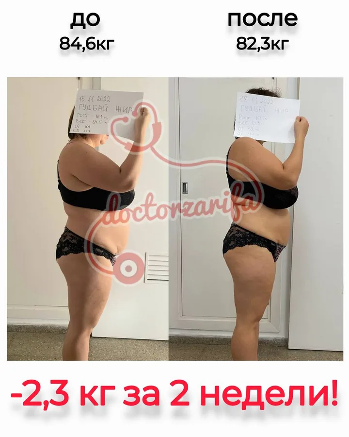 Результат пациента — до и после