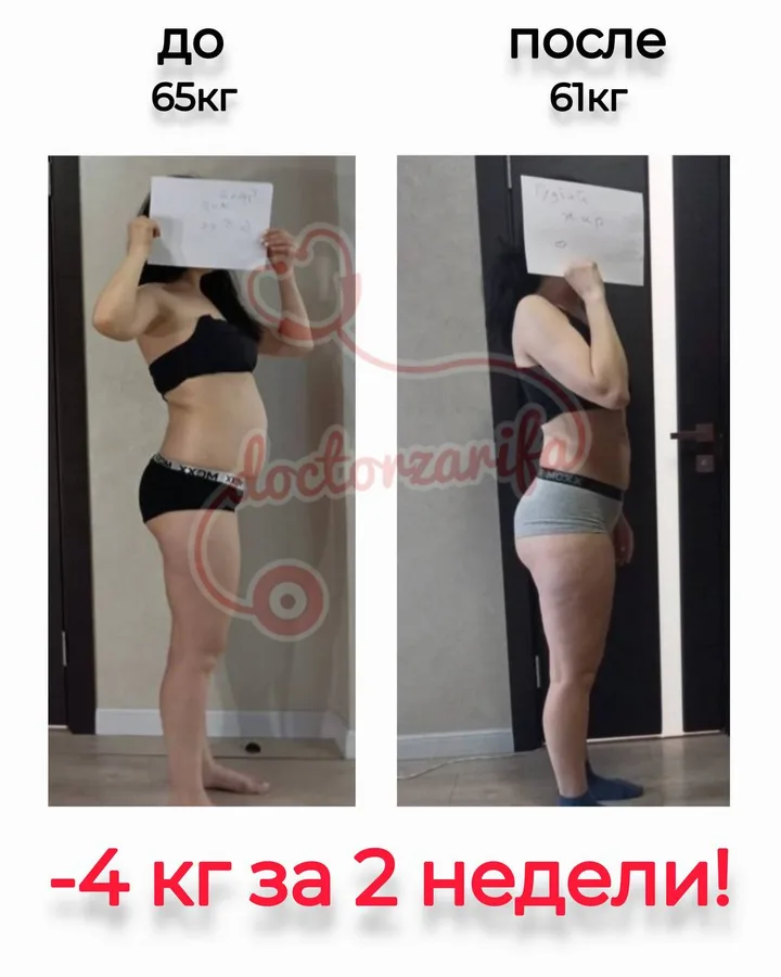 Результат пациента — до и после