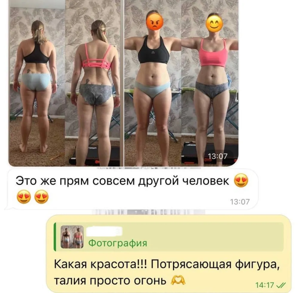 Результат пациентки до и после снижения веса по программе «Стройность 5+»